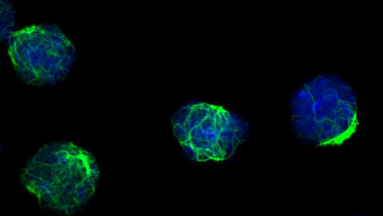 Regulatory T cells fluorescently labeled for vimentin