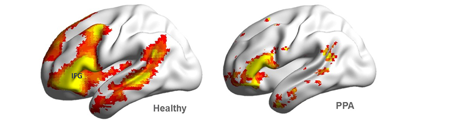  Resting state functional connectivity maps