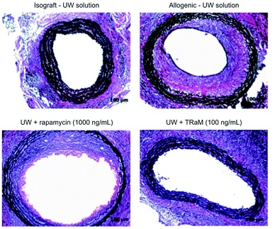 Histological analysis of allografts for vasculopathy