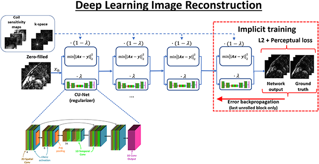 An illustration of deep learning image reconstruction