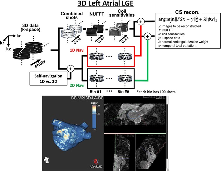 An illustrative example of our pulse sequencing programming: 3D LGE image and the corresponding fibrosis map obtained from a patient with atrial fibrillation