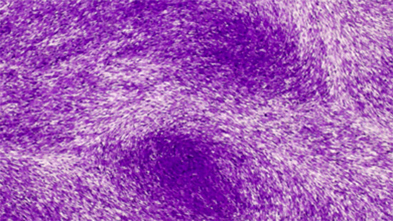 A cellular image of oncogenic viral miRNA