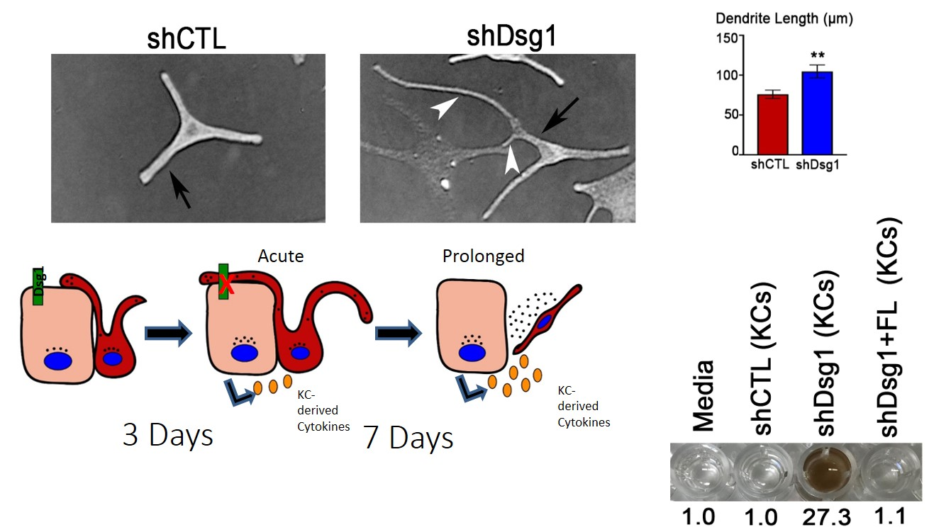 MCs exposed to conditioned media from Dsg1-deficient KCs change morphology and behavior