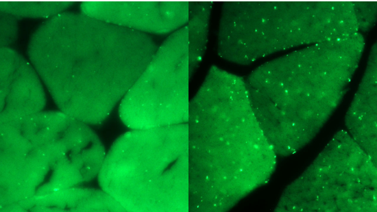 Exercise-Indced Aphagy in Skeleal Mscle Visalized by GFP-LC3