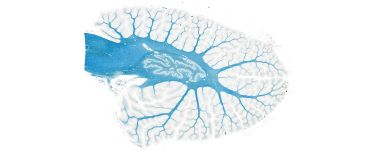 Luxol Fast Blue stain of an entire cerebellum hemisphere