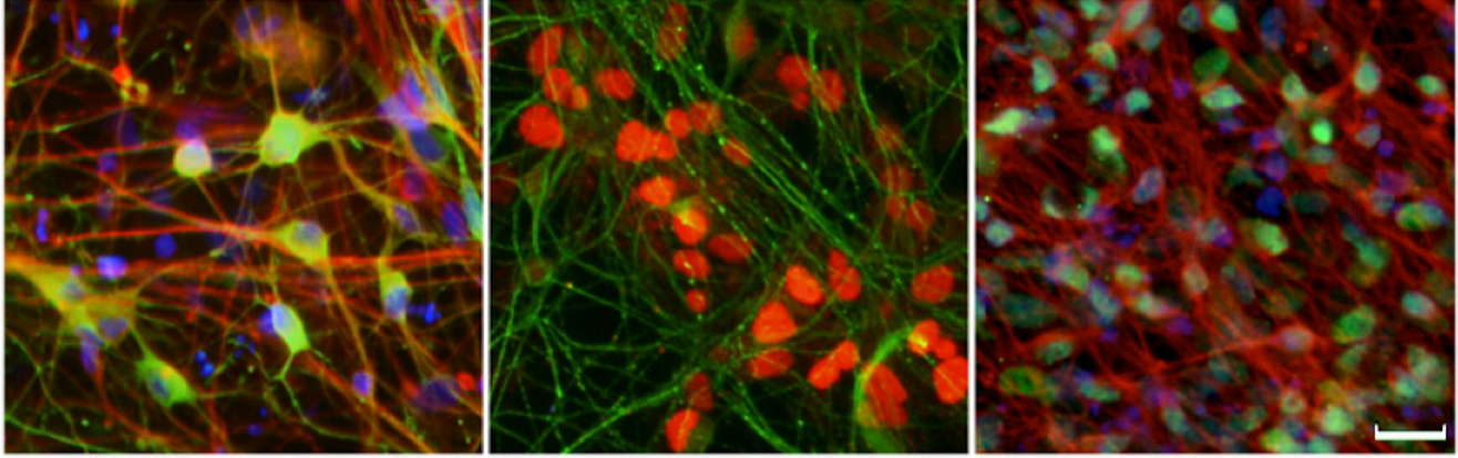 Dopaminergic neurons differentiated from Parkinson’s disease patient-derived induced pluripotent stem cells (iPSCs)