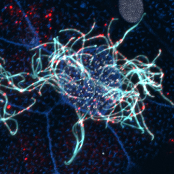 A confocal image of a multiciliated cell with actin in purple, acetylated tubulin marking cilia in cyan and adenylate kinase 7 in red. 