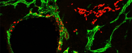 Mitochondria and lymphatic development