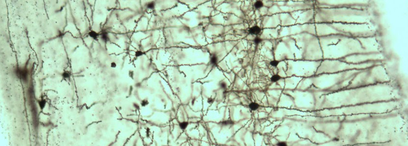 ataxia microscope view