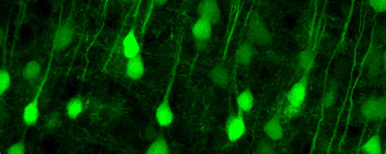 Visualization of Upper Motor Neurons