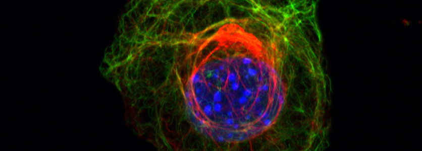Research: Karen Ridge Lab: Feinberg School of Medicine