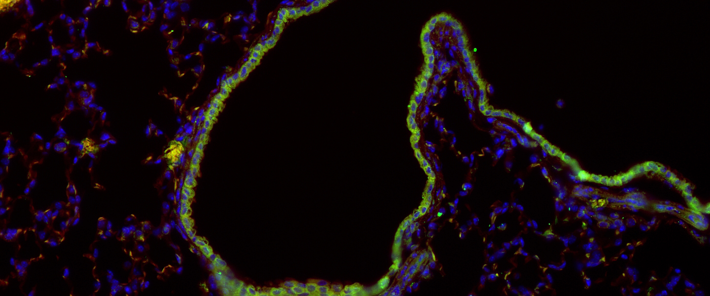 Home: Karen Ridge Lab: Feinberg School of Medicine