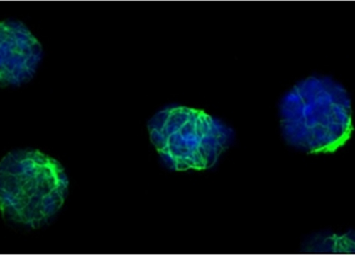 Vimenin in Reglary T Cells