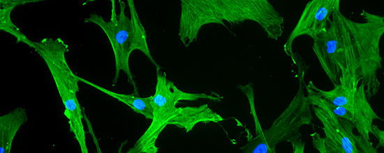Bladder Tissue Engineering: Mesenchymal Stem Cells and Elastomeric Scaffolds