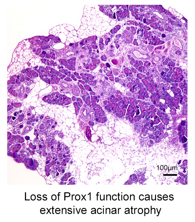 Loss of Prox1 function causes extensive acinar atrophy