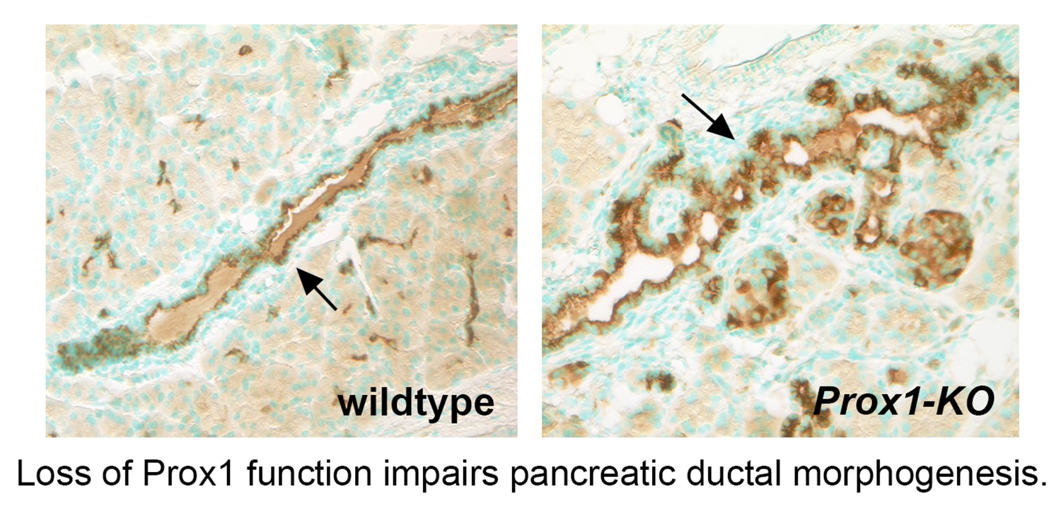 Loss of Prox1 function impairs pancreatic ductal morphogenesis