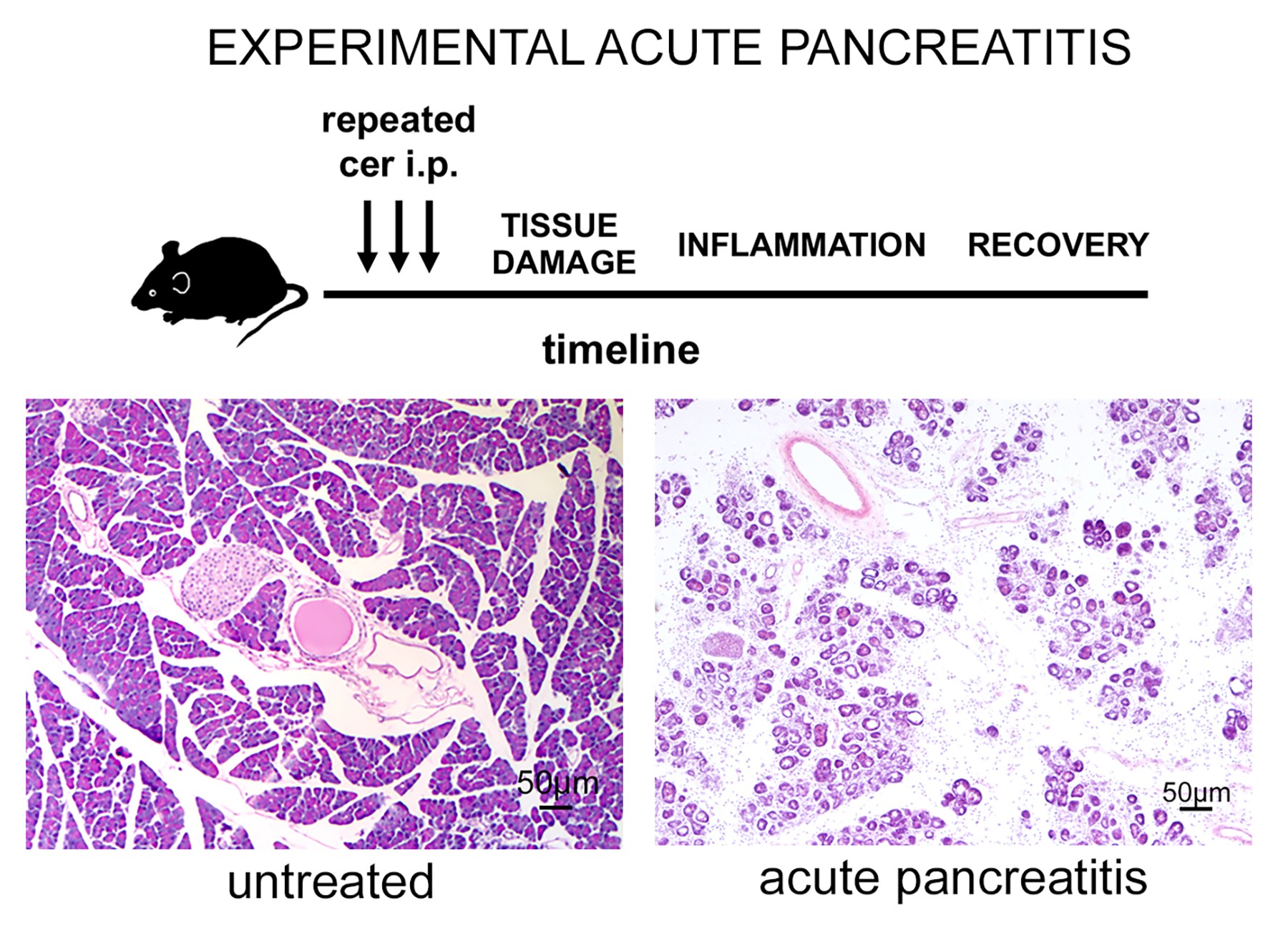 Experimental pancreatitis