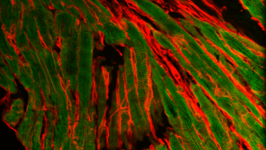 Immunofluorescence studies highlight structural changes in adult myocardium in the setting of pathological stress
