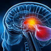PitNET Project Receives Funding From Malnati Brain Tumor Institute